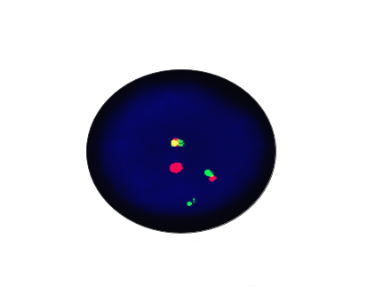 C-MYC/IGH Fusion Gene Detection Kit