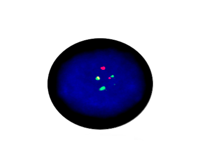 BCL2/IGH Gene Fusion Detection Kit