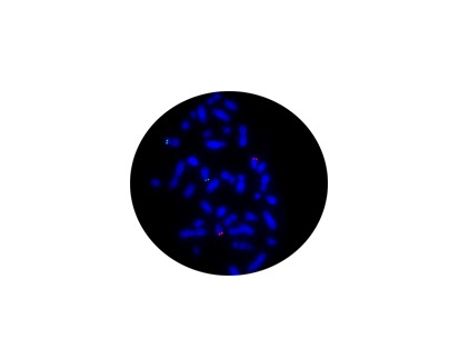 ETV6/NTRK3 Fusion Gene t (12;15) Probe Reagent (Fluorescence in Situ Hybridization)