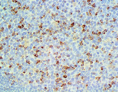 CD152/CTLA-4