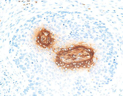 Carcinoembryonic Antigen(CEA),anti-mouse, monoclonal, COL-1