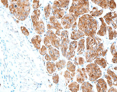 Chromogranin A(CgA)