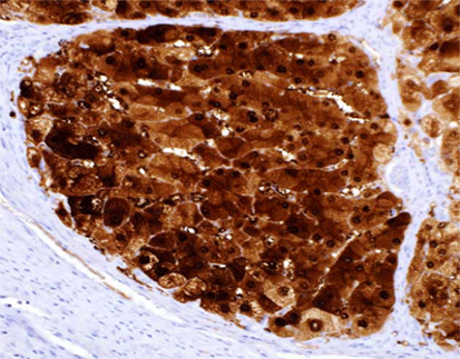 Arginase 1