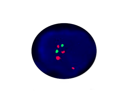 C-MYC(8q24) Gene Detection Kit