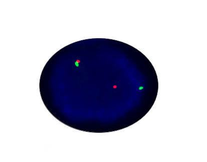 ERG Gene Rearrangement Detection Kit