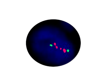 AR Gene Amplification Detection Kit