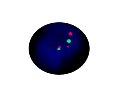 BCL1 (CCND1) Gene Amplification Detection Kit