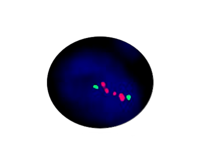 MYCN Gene Amplification Detection Kit