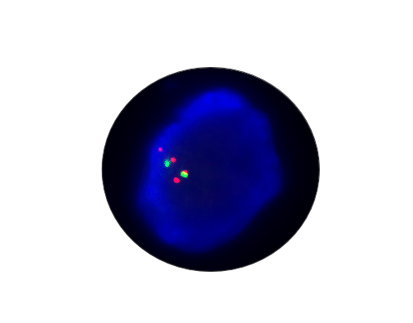 MDM4 Gene Amplification Detection Kit