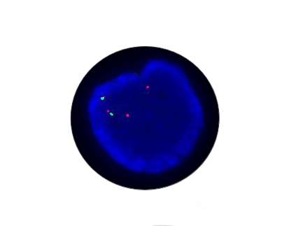 MLL（KMT2A）Gene Amplification Detection Kit