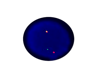 FKHR Split Gene Detection Kit