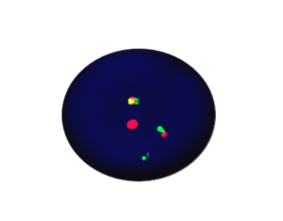 E2A/PBX1 Fusion Gene Detection Kit