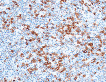 CD30,anti-mouse,C5E10