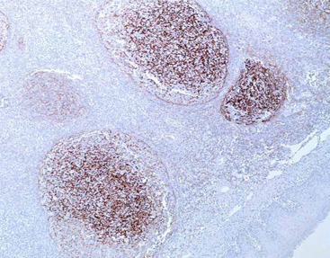 CD35