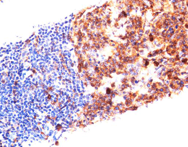 CD38