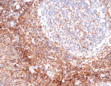 CD44 (H-CAM)