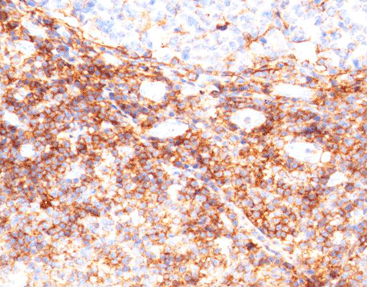 CD44