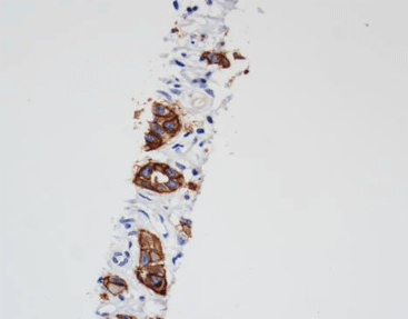 CD44V6