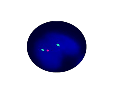 P53 Gene Detection Kit