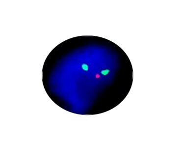 ATM Gene Deletion Detection Kit