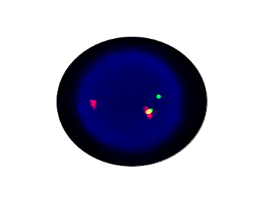 BCL1 Breakapart Detection Kit