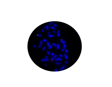 ETV6/NTRK3 Fusion Gene t (12;15) Probe Reagent (Fluorescence in Situ Hybridization)