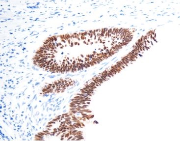 Celnovte CDX2 NordiQC Assessment