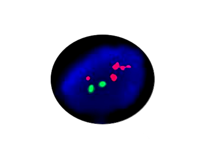 ESR1 Gene Amplification Detection Probe