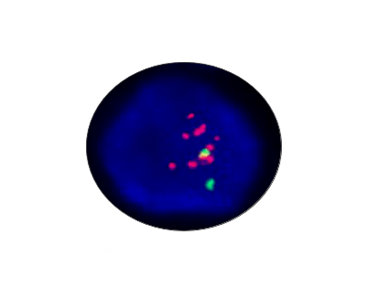 EGFR Gene Detection Kit