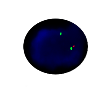 P53 Gene Detection Kit