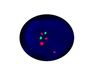 C-MYC(8q24) Gene Detection Kit