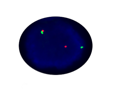 ERG Gene Rearrangement Detection Kit