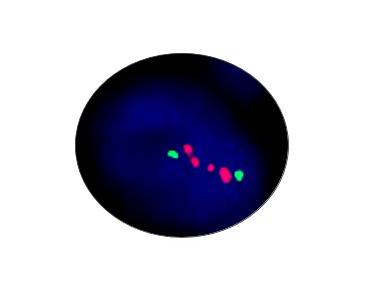 AR Gene Amplification Detection Kit