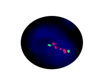 MYCN Gene Amplification Detection Kit