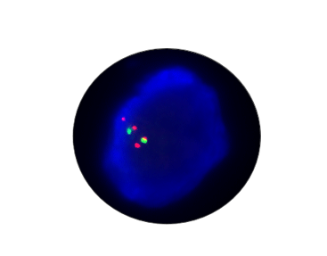 MDM4 Gene Amplification Detection Kit