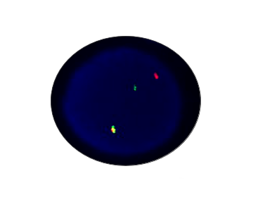 EWSR1 Split Gene Detection Kit