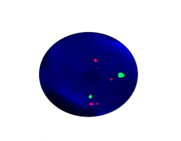 AURKB Gene Amplification Detection Kit
