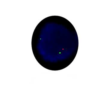 1p/19q Deletion Detection Kit