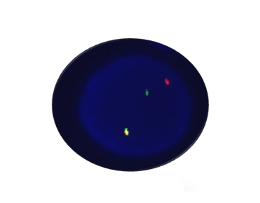 CBFB Breakapart Detection Kit