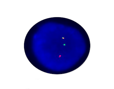 EVI Breakapart Detection Kit