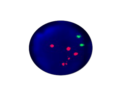 C-MYC(8q24) Gene Amplification Detection Kit