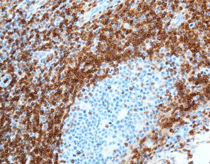 Bcl-2 oncoprotein