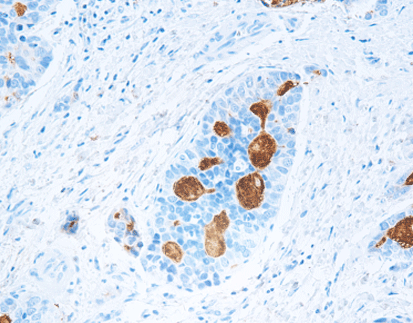 Alpha Fetoprotein (AFP),anti-mouse,monoclonal, C1B1