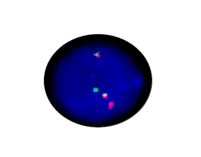 TEL(ETV6)/AML Gene Fusion Detection Kit