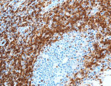 Bcl-2 oncoprotein