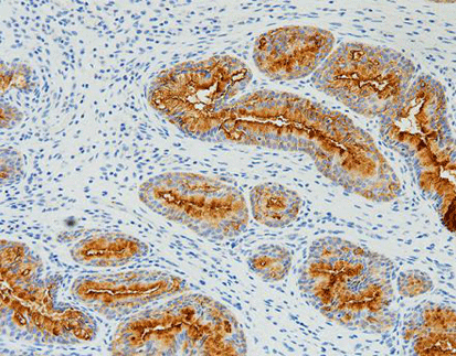 CA125,anti-mouse,monoclonal,OC125