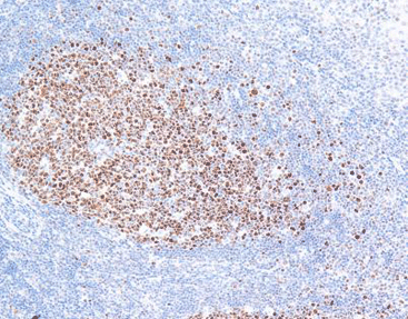 Bcl-6 oncoprotein