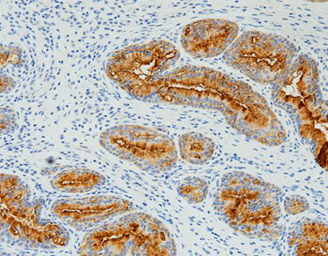 CA125,anti-mouse,monoclonal,OC125