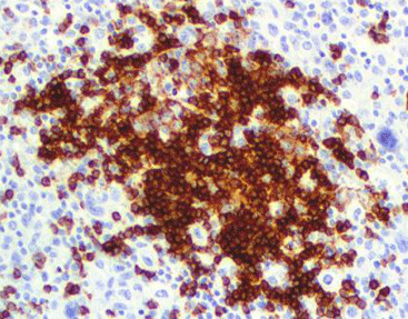 CD45RA