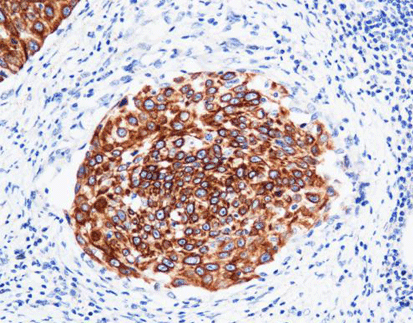 Cytokeratin 5 CK5